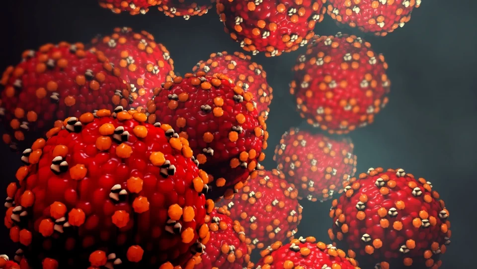 MEASLES
