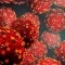 MEASLES